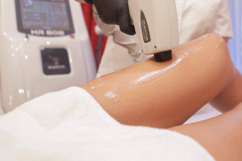 Tot ce trebuie să știi despre epilarea permanentă cu laser