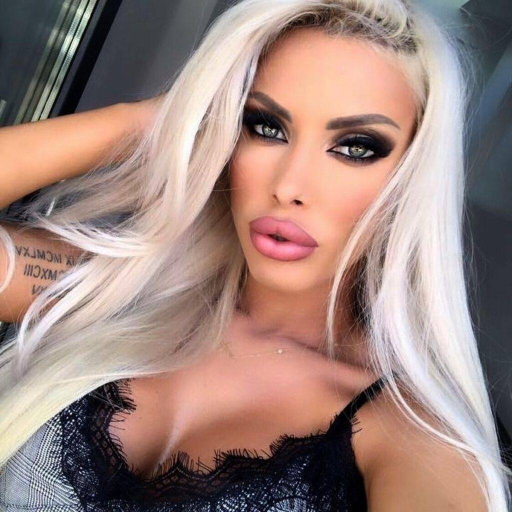 Loredana Chivu are probleme grave de sănătate! A leșinat până să ajungă salvarea!