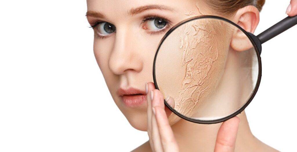 Cum putem avea grijă de tenul uscat în perioada rece? Ce pași trebuie să urmăm?
