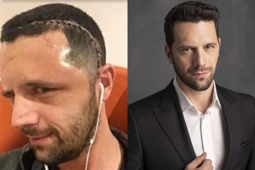 Cine a fost necondiționat alături de Adrian Nartea în perioada în care a fost nevoit să se opereze de tumoare la cap